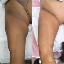 Promoción Sicarú 3